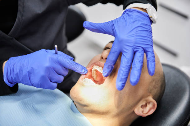 Best Broken or Cracked Tooth Emergency Dentist in Blue Ridge, TX